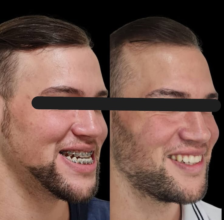 Ortognática1